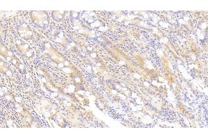 Immunohistochemistry (IHC) image for anti-Syndecan Binding Protein (Syntenin) 2 (SDCBP2) (AA 1-292) antibody (ABIN7435382)