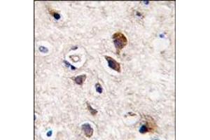 Formalin-fixed and paraffin-embedded human brain tissue reacted with PKC gamma antibody (C-term), which was peroxidase-conjugated to the secondary antibody, followed by DAB staining. (PKC gamma 抗体  (C-Term))