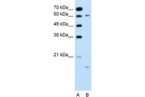 Western Blotting (WB) image for anti-Cytochrome P450, Family 4, Subfamily A, Polypeptide 22 (CYP4A22) (N-Term) antibody (ABIN2773793)