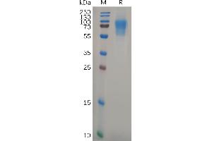 SDS-PAGE (SDS) image for CD6 (CD6) (AA 18-398) protein (His tag) (ABIN6964351)