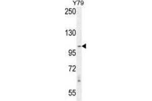 Western blot analysis in Y79 cell line lysates (35ug/lane) using RASAL3  Antibody (C-term).