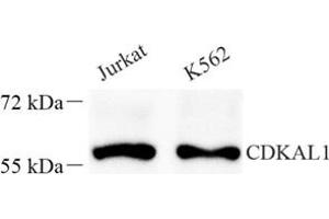 Western blot analysis of Cdkal1 (ABIN7073414) at dilution of 1: 400 (CDKAL1 抗体)