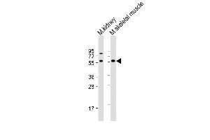 All lanes : Anti-Acvr2b Antibody (Center) at 1:1000 dilution Lane 1: mouse kidney lysate Lane 2: mouse skeletal muscle lysate Lysates/proteins at 20 μg per lane. (ACVR2B 抗体  (AA 148-176))