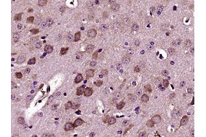 Immunohistochemistry (Paraffin-embedded Sections) (IHC (p)) image for anti-Versican (Vcan) (AA 3301-3396) antibody (ABIN741660)