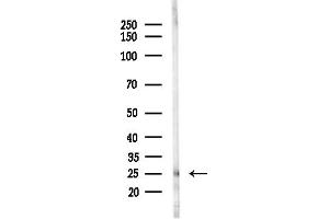 anti-Leucine Zipper, Down-Regulated in Cancer 1-Like (LDOC1L) antibody