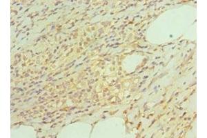 Immunohistochemistry of paraffin-embedded human epityphlon tissue using ABIN7164899 at dilution of 1:100 (TAC1 抗体  (AA 1-129))
