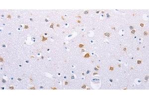 Immunohistochemistry of paraffin-embedded Human brain using HMGB3 Polyclonal Antibody at dilution of 1:30 (HMGB3 抗体)