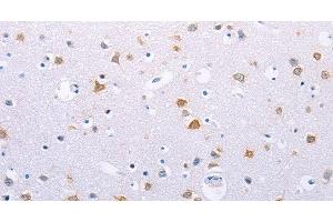 Immunohistochemistry of paraffin-embedded Human brain using HMGB3 Polyclonal Antibody at dilution of 1:30