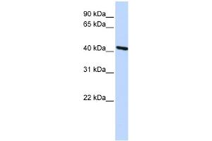 WB Suggested Anti-TMOD3 Antibody Titration: 0. (TMOD3 抗体  (Middle Region))