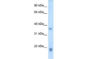 Growth Hormone 2 antibody used at 5 ug/ml to detect target protein.