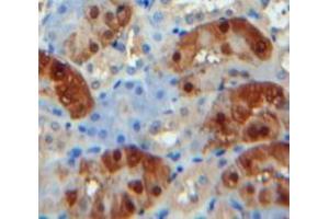 IHC-P analysis of Kidney tissue, with DAB staining. (CPB1 抗体  (AA 111-417))