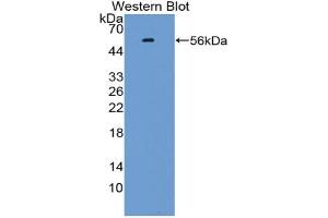 Western blot analysis of the recombinant protein. (KLF10/TIEG1 抗体  (AA 1-210))