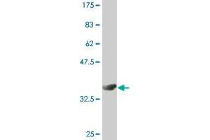 Western Blotting (WB) image for anti-RAB5A, Member RAS Oncogene Family (RAB5A) (AA 116-215) antibody (ABIN519585)