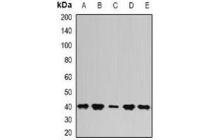Western blot analysis of PSAT1 expression in Hela (A), SKOV3 (B), mouse kidney (C), mouse thymus (D), rat brain (E) whole cell lysates. (PSAT1 抗体)