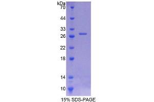 SDS-PAGE (SDS) image for Intersectin 1 (ITSN1) (AA 1-227) protein (His tag) (ABIN6238711)