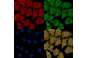 PFKM Mouse Monoclonal Antibody staining HepG2 cells by IF/ICC.
