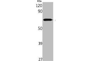 Western Blot analysis of rat kidney cells using Aladin Polyclonal Antibody (Adracalin 抗体  (C-Term))
