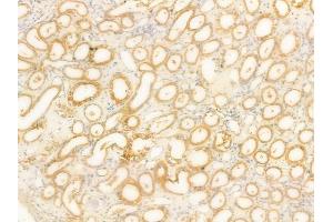 ABIN6266202 and ABIN6277355 at 1/100 staining human normal kidney tissue by IHC-P. (Dopamine Receptor d1 抗体  (N-Term))