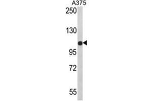 Western blot analysis of PALA Antibody (N-term) in A375 cell line lysates (35ug/lane). (TECPR1 / PALA (N-Term) 抗体)