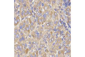 Immunohistochemistry (IHC) image for anti-Kinesin Light Chain 1 (KLC1) antibody (ABIN1876732) (KLC1 抗体)