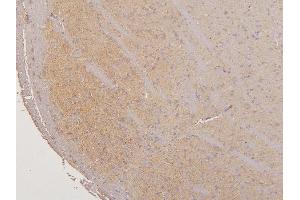 IHC analysis of LMTK3 using anti-LMTK3 antibody (ABIN6719386).