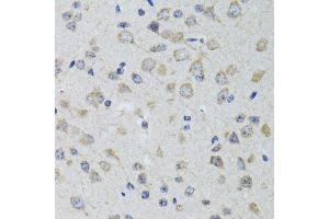 Immunohistochemistry of paraffin-embedded rat brain using HTR3A antibody. (Serotonin Receptor 3A 抗体  (AA 24-241))