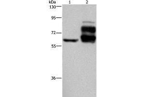 Western Blot analysis of Jurkat cell and Human rectal cancer tissue using PCSK9 Polyclonal Antibody at dilution of 1:200 (PCSK9 抗体)