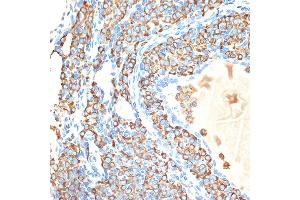 Immunohistochemistry of paraffin-embedded rat ovary using CYPOR Rabbit mAb (ABIN7269151) at dilution of 1:100 (40x lens). (POR 抗体)