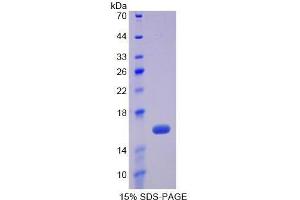 SDS-PAGE (SDS) image for Fibronectin (AA 2206-2337) protein (His tag) (ABIN1170437)