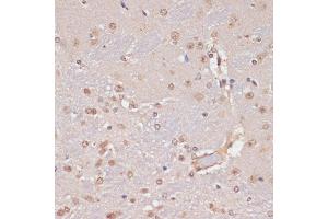 Immunohistochemistry of paraffin-embedded mouse brain using PIDD antibody (ABIN1680710, ABIN3019230, ABIN3019231, ABIN5664897 and ABIN6220775) at dilution of 1:100 (40x lens). (PIDD 抗体  (AA 1-85))