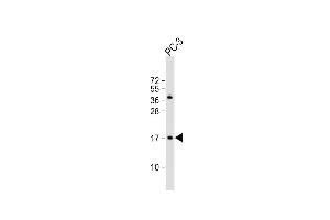 Anti-NDUF3 Antibody (N-term) at 1:1000 dilution + PC-3 whole cell lysate Lysates/proteins at 20 μg per lane. (NDUFAF3 抗体  (N-Term))
