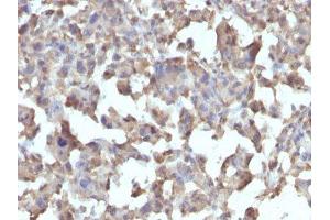 Image no. 1 for anti-Tumor Necrosis Factor alpha (TNF alpha) antibody (ABIN6171941) (TNF alpha 抗体)