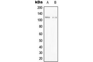 Western blot analysis of PPFIBP1 expression in Jurkat (A), HEK293T (B) whole cell lysates. (PPFIBP1 抗体  (Center))
