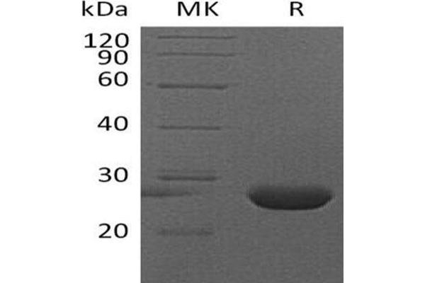 FGF9 Protein (His tag)