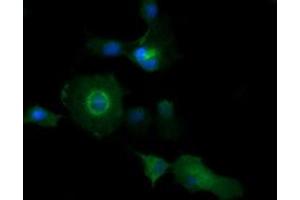 Image no. 1 for anti-Phosphatidylinositol-4-Phosphate 3-Kinase, Catalytic Subunit Type 2 beta (PIK3C2B) antibody (ABIN1500198)