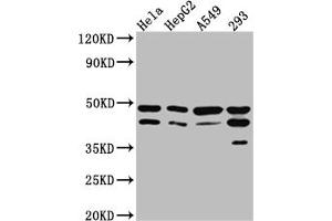 Western Blot Positive WB detected in: Hela whole cell lysate, HepG2 whole cell lysate, A549 whole cell lysate, 293 whole cell lysate All lanes: GSK3 beta Antibody at 1:1000 Secondary Goat polyclonal to rabbit IgG at 1/50000 dilution Predicted band size: 47, 49 kDa Observed band size: 47 kDa (Recombinant GSK3 beta 抗体)