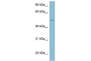 WB Suggested Anti-LBP Antibody Titration:  0. (LBP 抗体  (Middle Region))