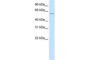Western Blotting (WB) image for anti-Homeobox D3 (HOXD3) antibody (ABIN2461608) (HOXD3 抗体)