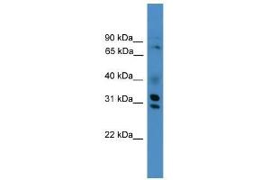 GIPC3 antibody used at 0. (GIPC3 抗体  (Middle Region))