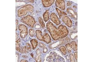 Immunohistochemical staining of human kidney with CACNA1B polyclonal antibody  shows strong cytoplasmic positivity in cells in tubules. (CACNA1B 抗体)