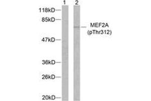 Western blot analysis of extracts from NIH-3T3 cells treated with PMA, using MEF2A (Phospho-Thr312) Antibody. (MEF2A 抗体  (pThr312))
