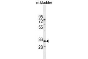 C17orf59 Antibody (Center) western blot analysis in mouse bladder tissue lysates (35µg/lane). (C17orf59 抗体  (Middle Region))