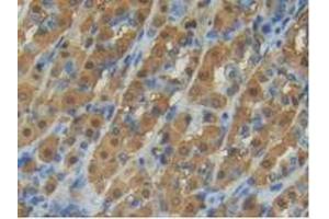 Immunohistochemistry (IHC) image for anti-Glutamic-Oxaloacetic Transaminase 1, Soluble (Aspartate Aminotransferase 1) (GOT1) (AA 1-413) antibody (ABIN7433267)