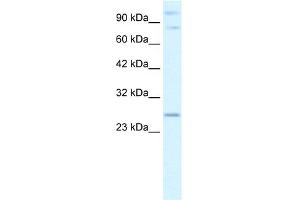 WB Suggested Anti-PCGF3 Antibody Titration:  2. (PCGF3 抗体  (Middle Region))