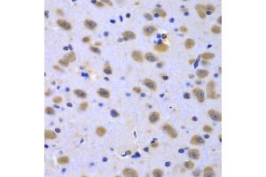 Immunohistochemistry of paraffin-embedded rat brain using CIAO1 antibody (ABIN5975509) at dilution of 1/100 (40x lens). (CIAO1 抗体)