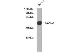 Western blot analysis of extracts of Jurkat cells using CCNE2 Polyclonal Antibody. (Cyclin E2 抗体)