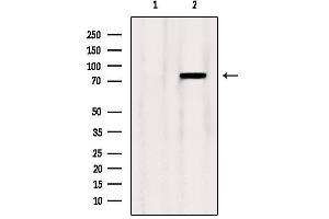 Western blot analysis of extracts from Mouse lung, using OSBP Antibody. (OSBP 抗体  (Internal Region))