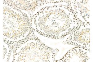 ABIN6259574 and ABIN6275790 at 1/100 staining Rat testis tissue by IHC-P. (CSRNP3 抗体  (Internal Region))