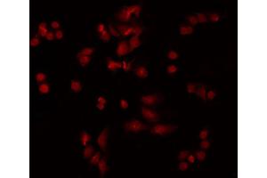 ABIN6277780 staining HeLa by IF/ICC. (PKC epsilon 抗体  (pSer729))