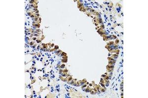 Immunohistochemistry of paraffin-embedded mouse lung using ESD antibody. (Esterase D 抗体  (AA 1-282))